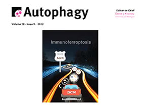 「輝駿客戶文章」Autophagy | 發(fā)現(xiàn)MIR516A在人類膀胱癌中的獨(dú)特作用